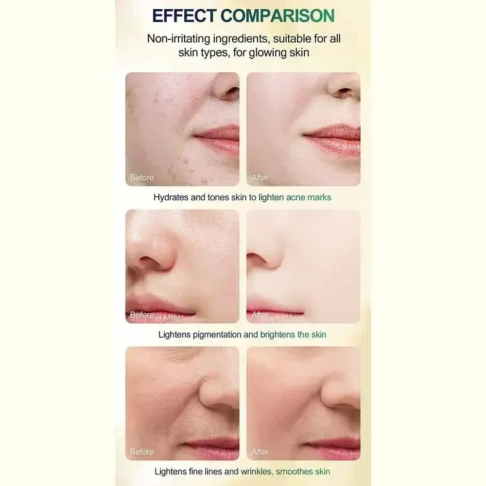 Exfoliante avanzado que ayuda a renovar la piel, aportando una apariencia más suave, fresca y luminosa. ✨ENVÍO GRATIS